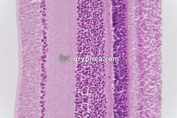 Rétine sans choroïde x100 - gryphea.org